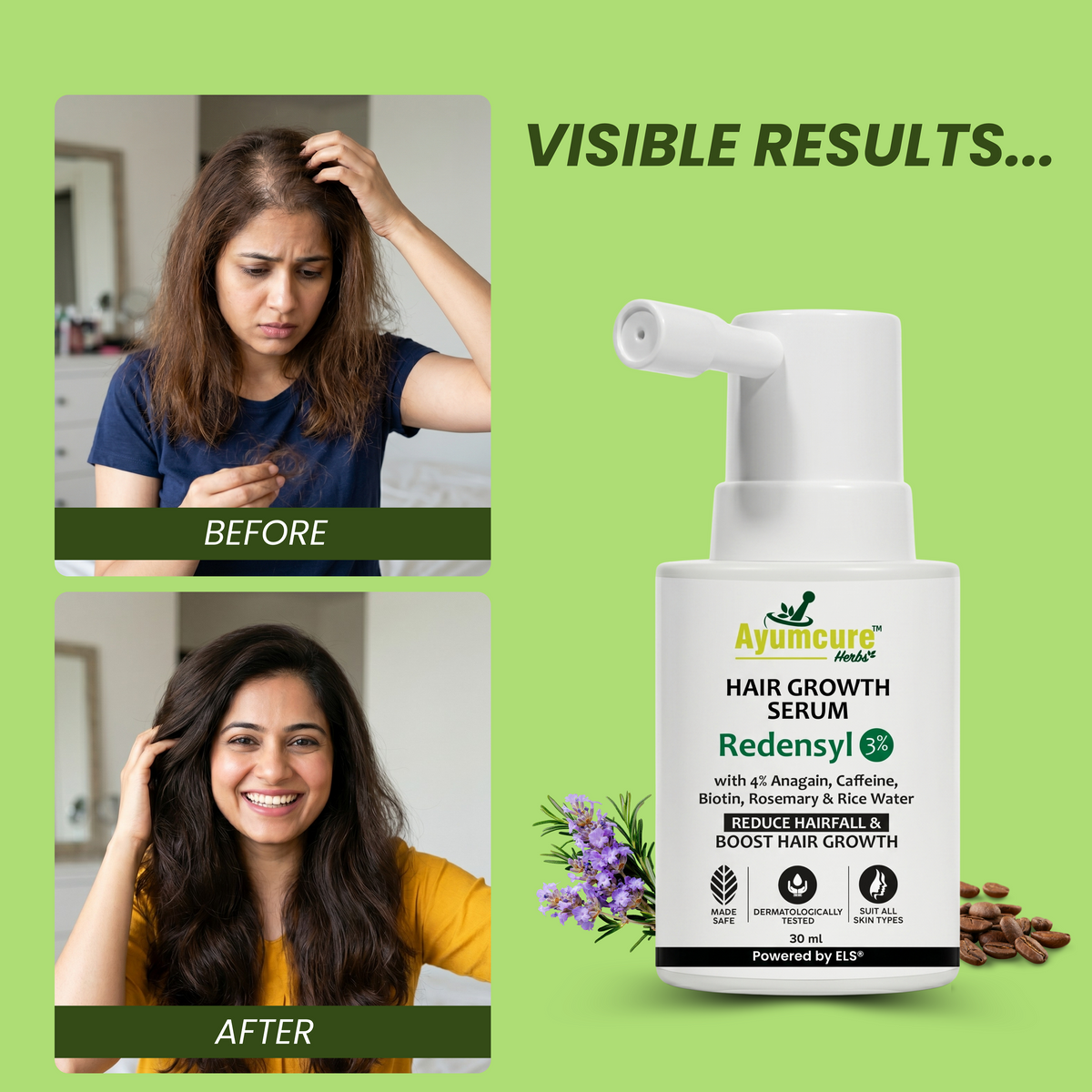 Hair Growth Serum – Biotin, Caffeine, Rice Water & Rosemary | Men & Women