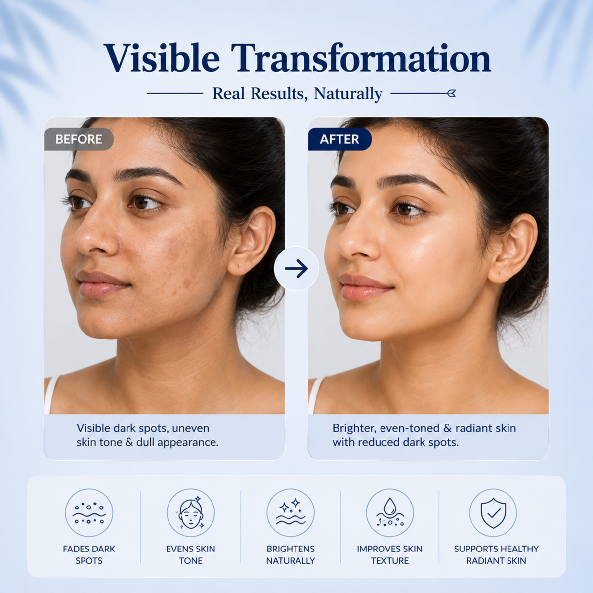 Night Cream – 1% Retinol, Alpha Arbutin & Glutathione for Pigmentation Repair | Unisex