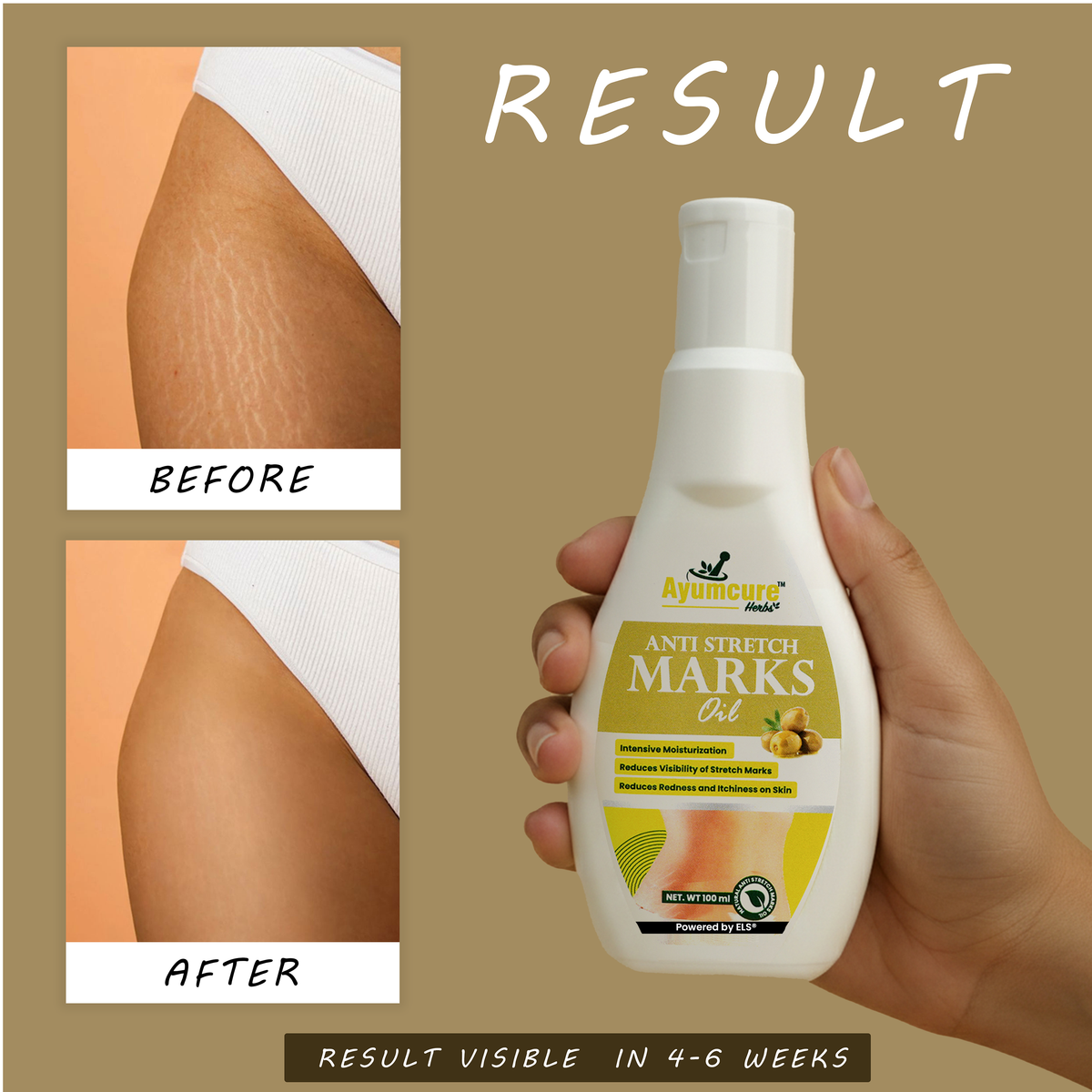Stretch Mark Solution Oil Scar Removal & Skin Elasticity For Women