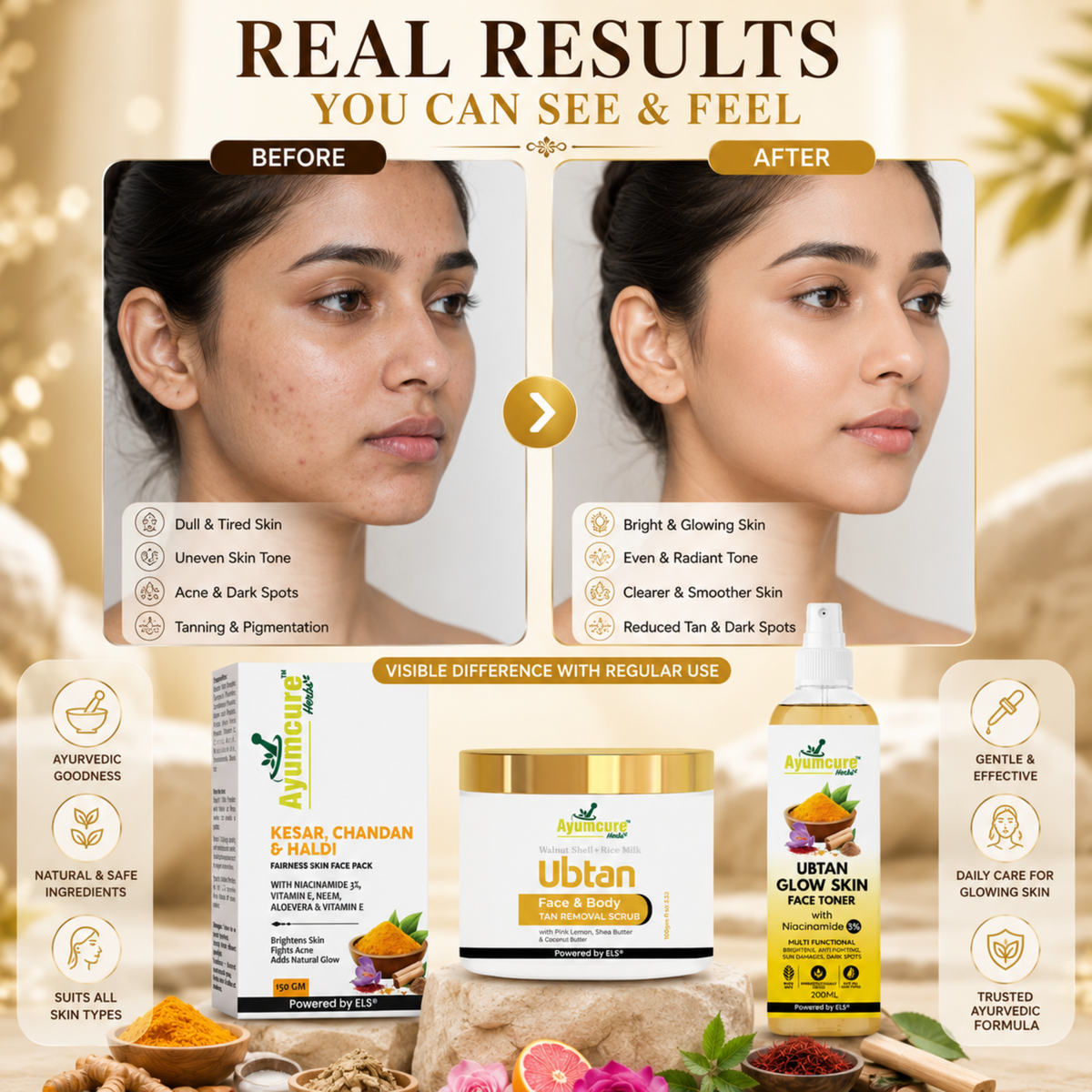 Ubtan Glow Combo: Face Pack + Toner + Scrub | 3% Niacinamide | Men & Women