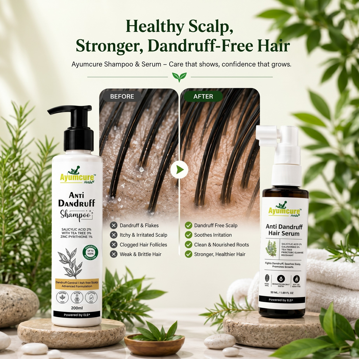 The Dandruff Fix Duo – 3% Tea Tree Shampoo + Anti-Dandruff Serum | Men & Women