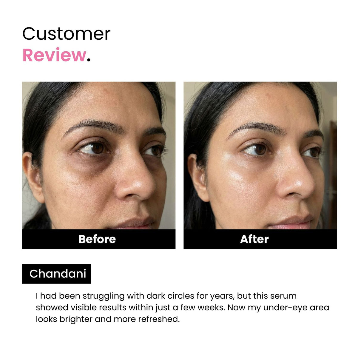 Anti-Dark Circle Serum with Niacinamide | Brightening | Men & Women