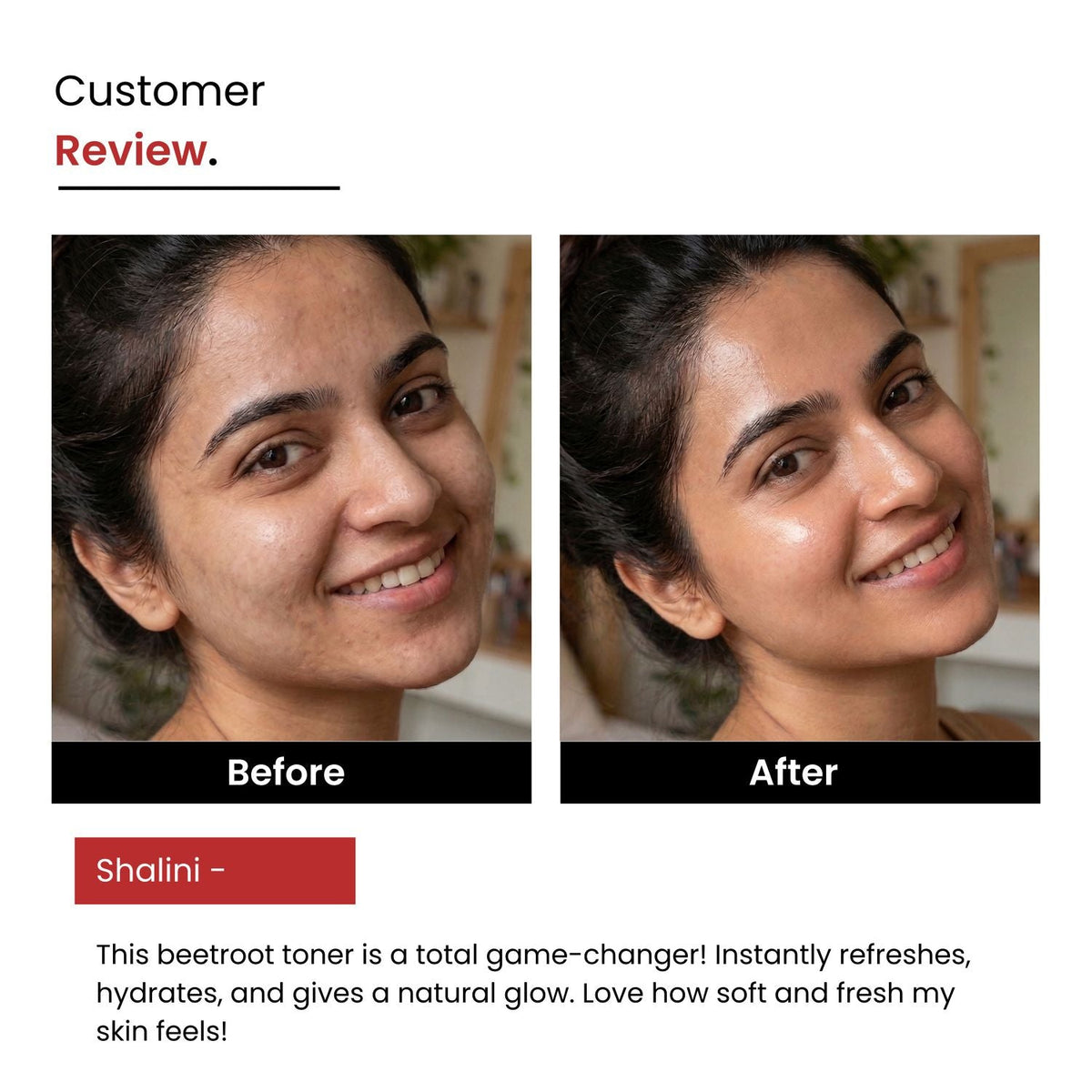 Beetroot Hyaluronic Face Mist & Toner | Glowing Skin | Unisex