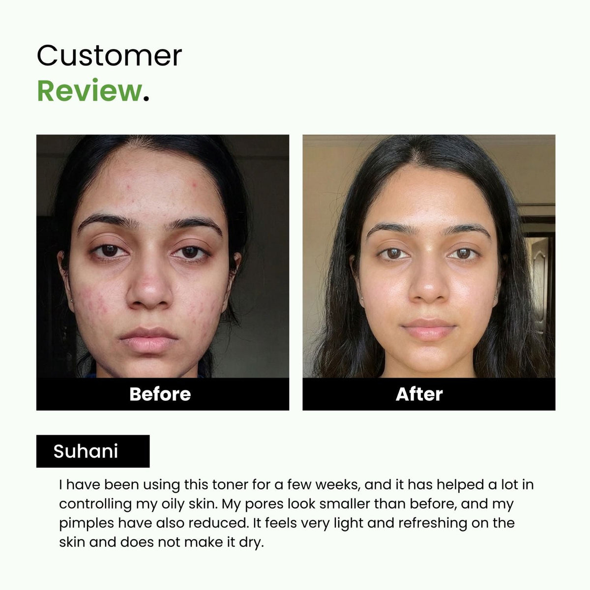 Green Tea & Niacinamide Pore-Tightening Face Toner | Normal & Oily Skin | Unisex