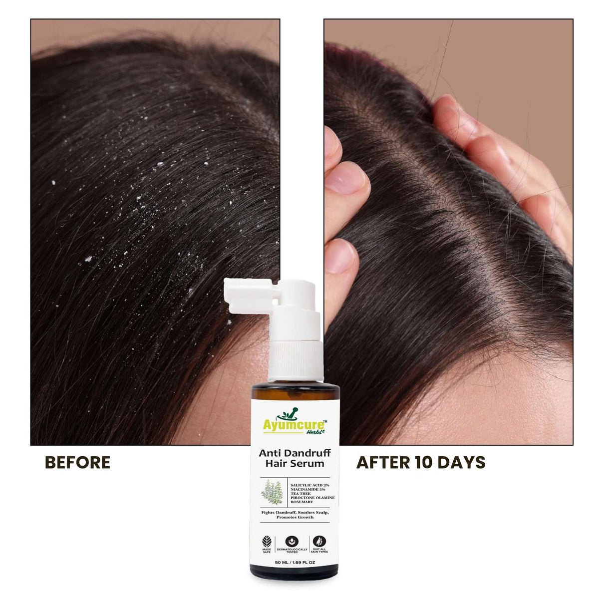 Anti-Dandruff Hair Serum | 2% Salicylic Acid, 3% Niacinamide & Tea Tree | Unisex