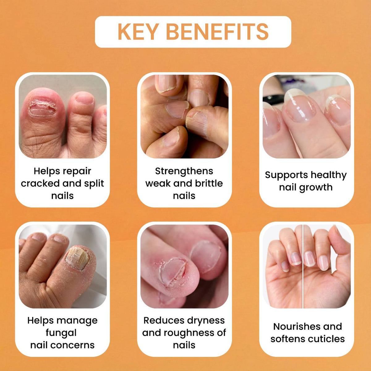 Nail Restore Serum | Repairs Weak, Brittle & Cracked Nails | Men & Women