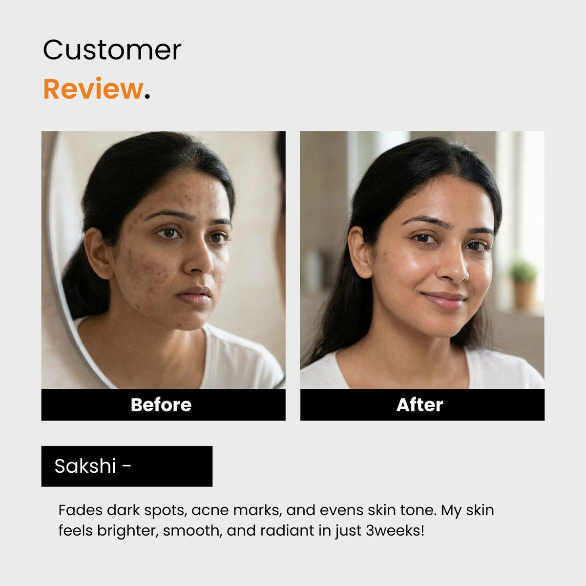 Niacinamide & Alpha Arbutin Face Serum | Brightening & Dark Spot Corrector | Unisex