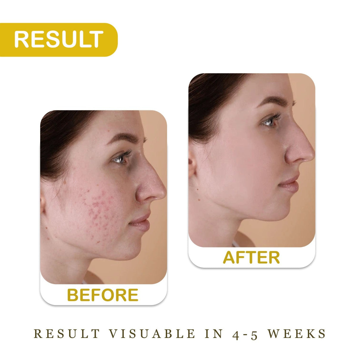 Vitamin C Serum + Radiance Face Pack | 3% Niacinamide, Kesar & Haldi | Men & Women