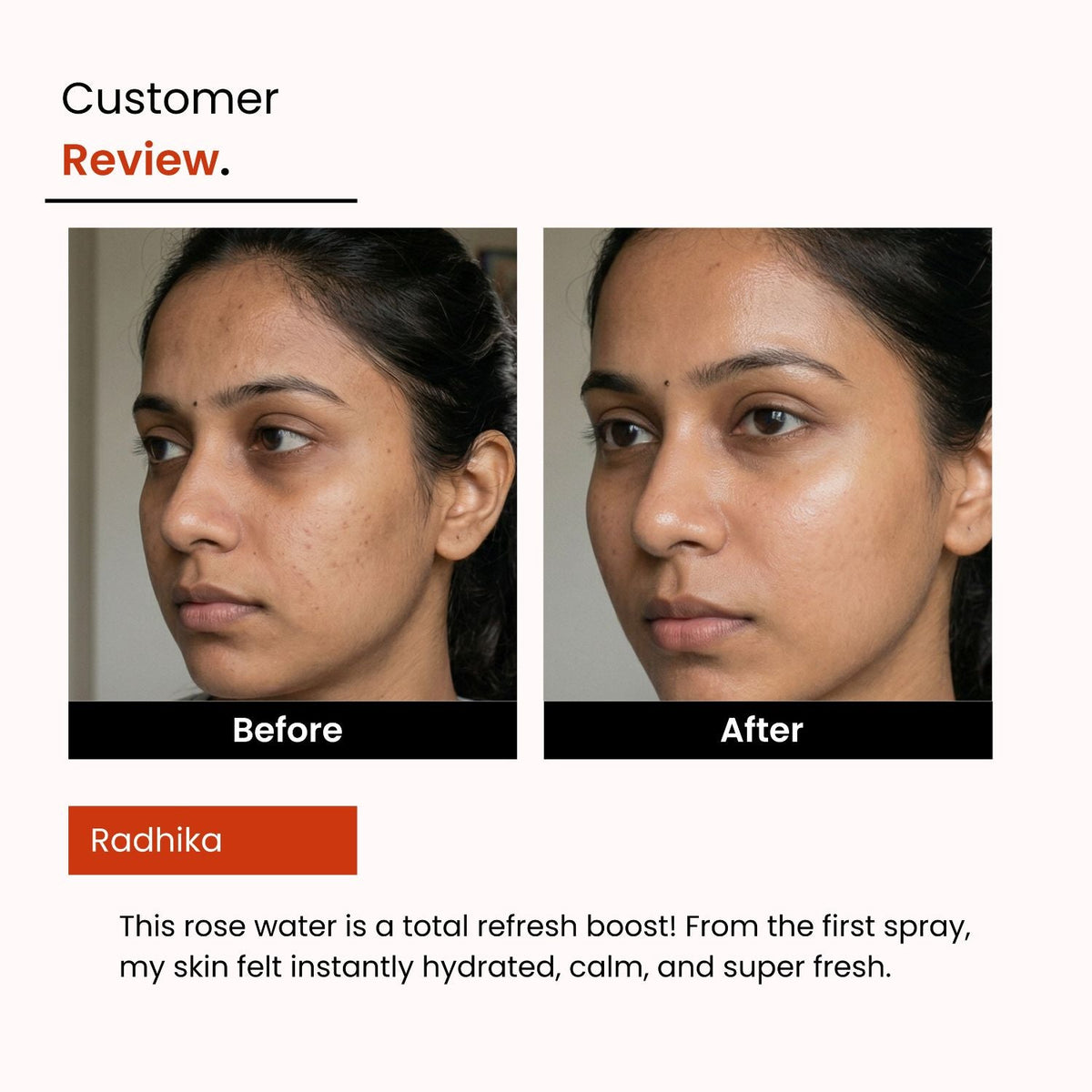 Pure Rose Water – Alcohol-Free Hydrating Face Toner | Glowing Skin | Unisex