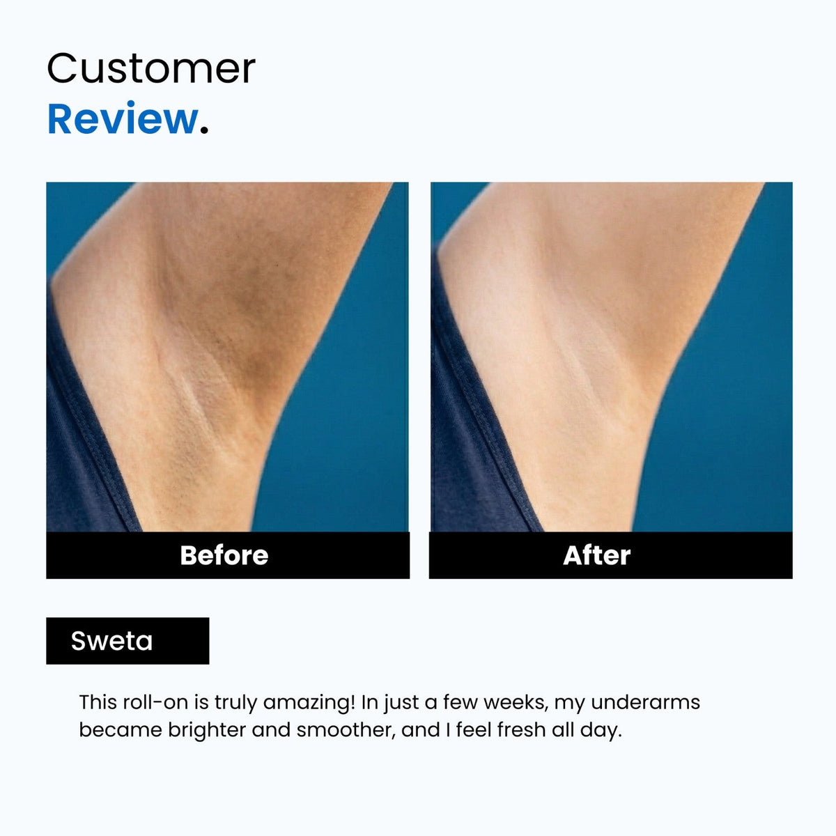 AHA 5% Underarm Roll-On | 1% Glutathione + Kojic Acid | 48H Odour Control | Unisex