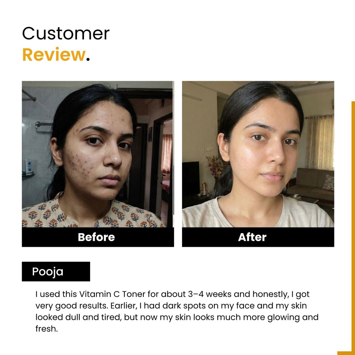 Vitamin C 1% + 3% Niacinamide Toner | Kakadu Plum | Pore-Tightening | All Skin Types