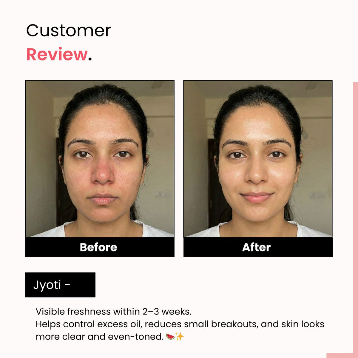 Watermelon Cooling Toner – 3% Niacinamide | Unclogs Pores & Refines Texture | Unisex